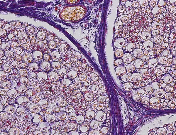 Nervio ciático que muestra un haz de fibras nerviosas - foto de stock
