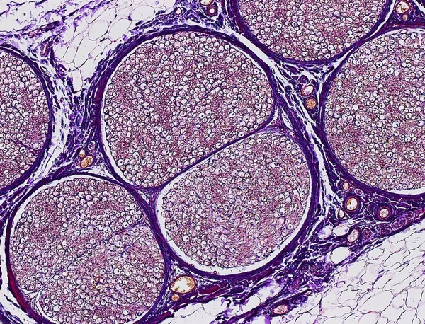 Nervo sciatico che mostra un fascio di fibre nervose — Foto stock