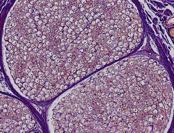 Nervo sciatico che mostra un fascio di fibre nervose — Foto stock