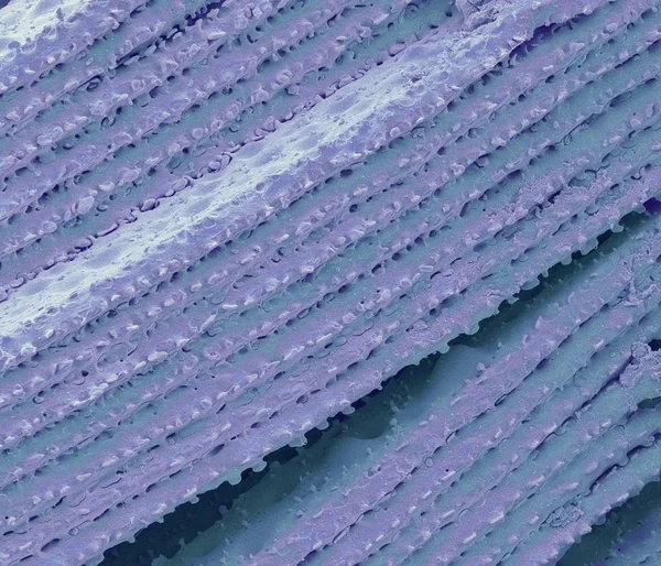 Lente cristallina dell'occhio — Foto stock