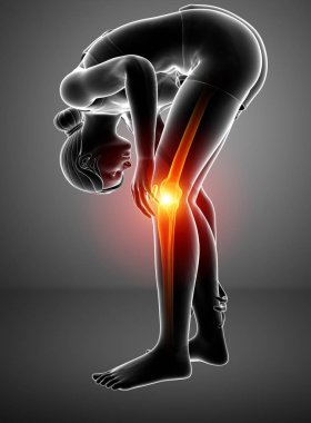 Kadın diz eklem ağrısı