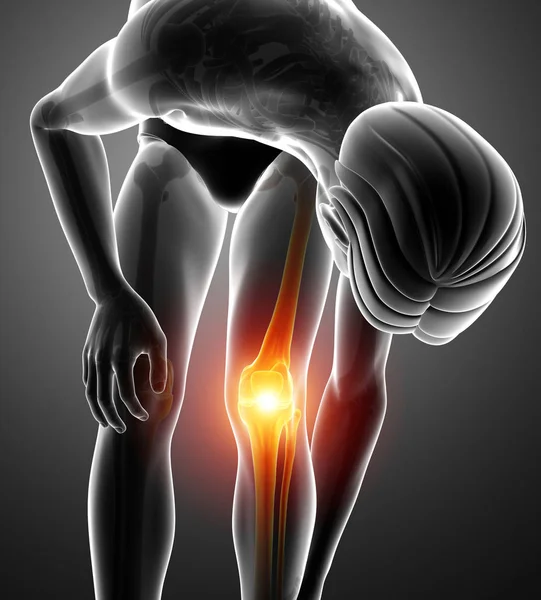 Male Knee pain — Stock Photo, Image