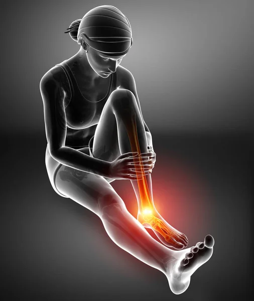 Female foot with ankle pain — Stock Photo, Image
