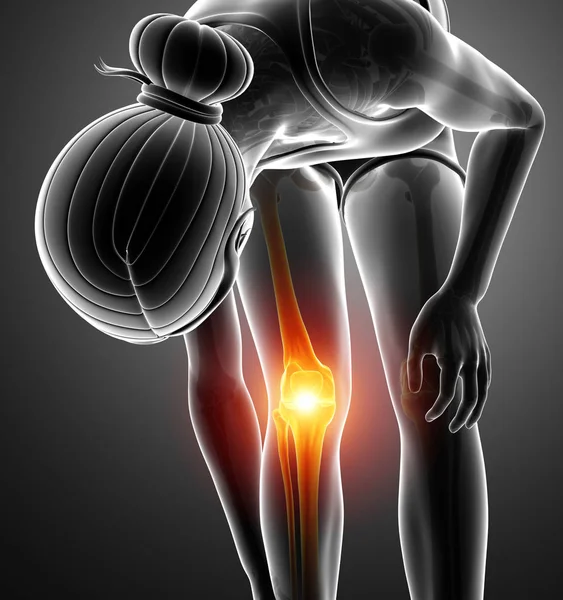 Vrouwen knie gewrichtspijn — Stockfoto