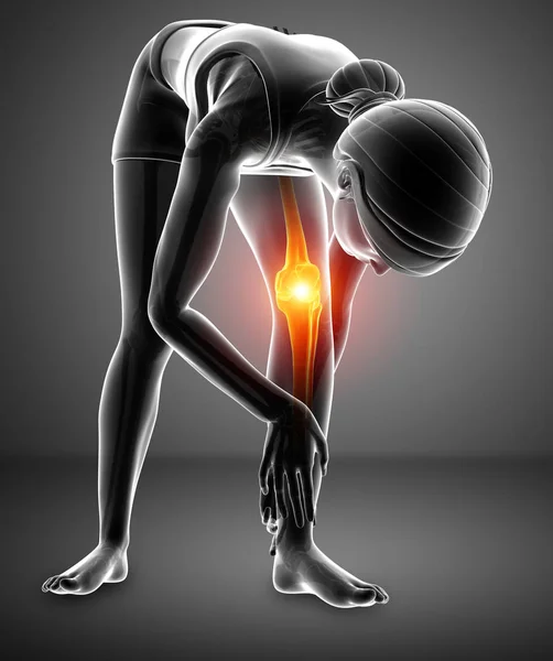 Vrouwen knie gewrichtspijn — Stockfoto