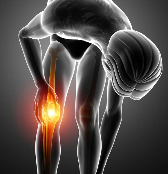Sakit lutut laki-laki — Stok Foto