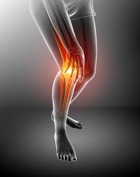 Mulheres Dor nas articulações do joelho — Fotografia de Stock