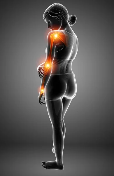 Women Feeling Arm joint pain — Stock Photo, Image