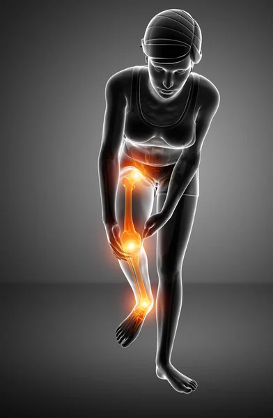 Γυναικείο πόδι πόνος στις αρθρώσεις — Φωτογραφία Αρχείου