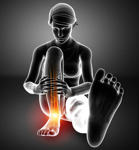Pie masculino con dolor en el tobillo — Foto de Stock