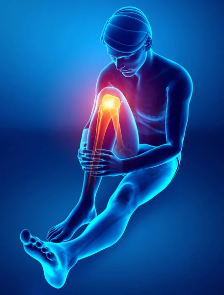 Mužské koleno bolest — Stock fotografie