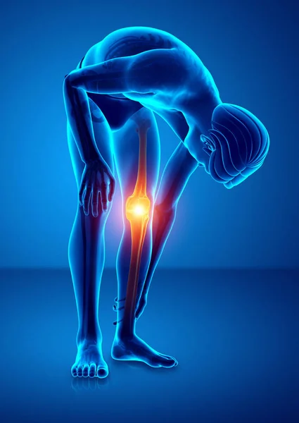 Male Knee pain — Stock Photo, Image