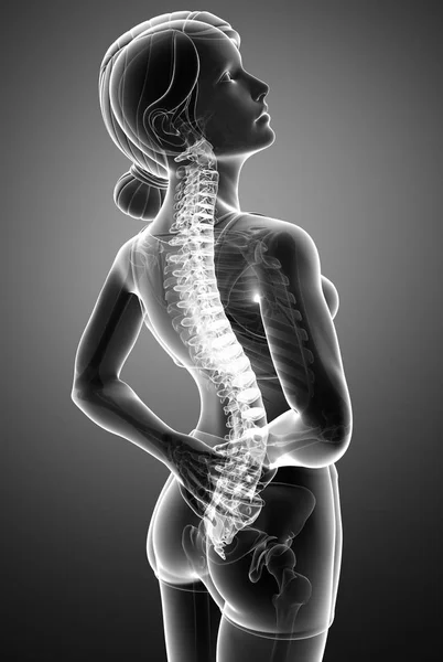 Женщины чувствуют боль в спине — стоковое фото