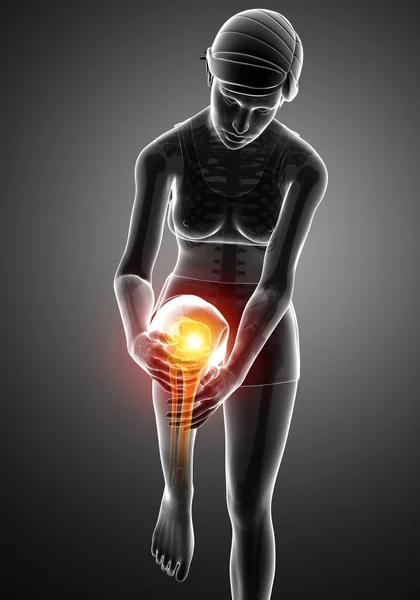 Mujer Knee dolor articular — Foto de Stock