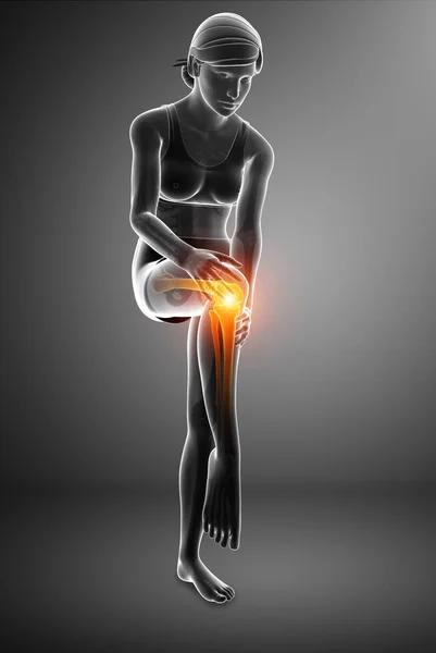 Mujer Knee dolor articular — Foto de Stock