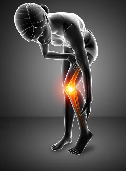 女性の膝の関節の痛み — ストック写真