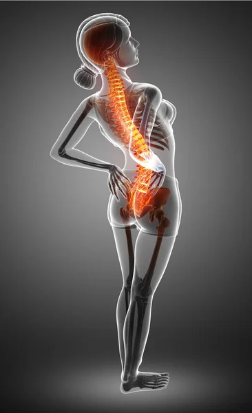 Women Feeling the Back pain — Stock Photo, Image