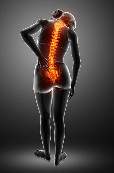 Женщины чувствуют боль в спине
 