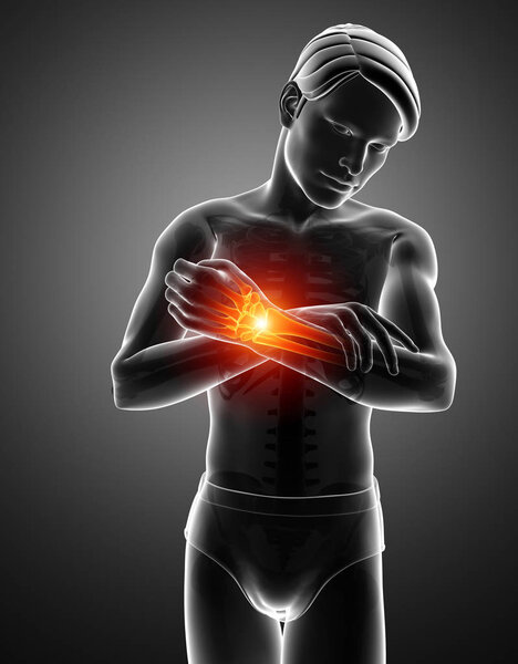 Люди чувствуют боль в запястье
