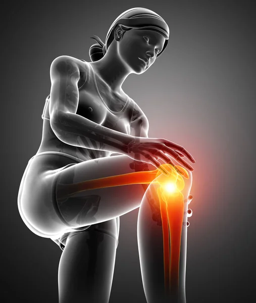 Mujer Knee dolor articular —  Fotos de Stock