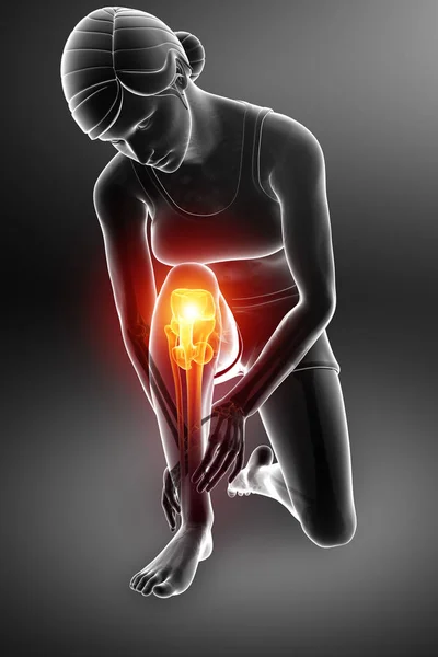 Women Knee joint pain — Stock Photo, Image