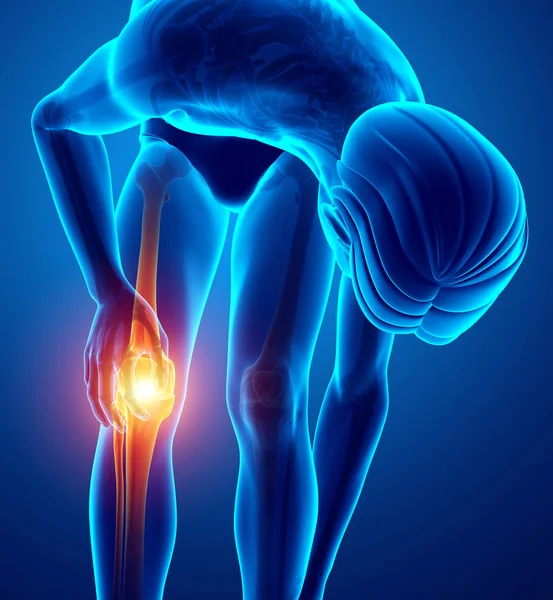 Male Knee pain — Stock Photo, Image