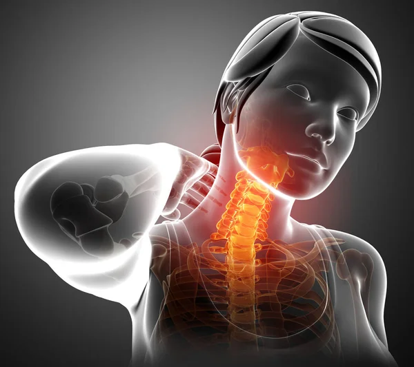 Women Feeling the Neck Pain — Stock Photo, Image