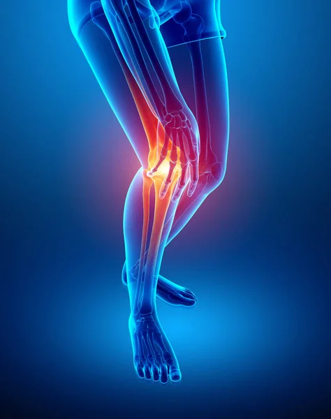 Mujer Knee dolor articular — Foto de Stock