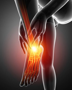 Erkek ayak ayak bileği ağrısı ile