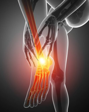 Erkek ayak ayak bileği ağrısı ile