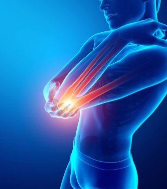 Erkekler duygu dirsek ağrısı