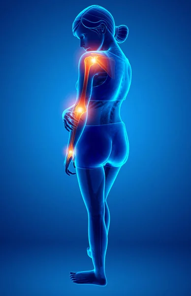 Women Feeling Arm joint pain — Stock Photo, Image