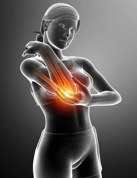 Feeling Elbow pain — Stock Photo, Image