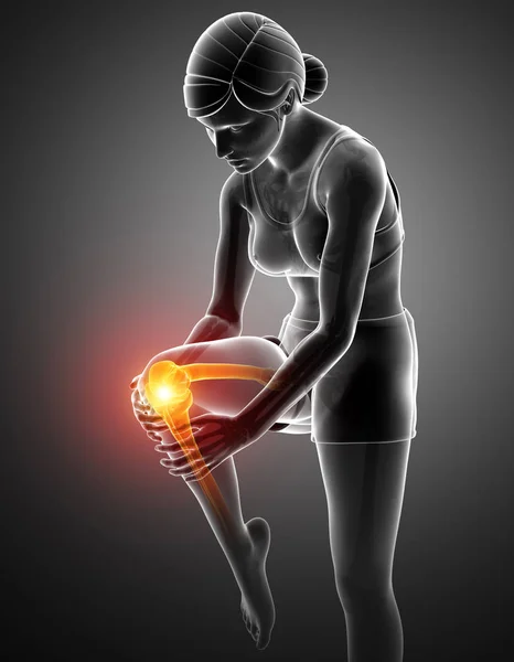 Women Knee joint pain — Stock Photo, Image