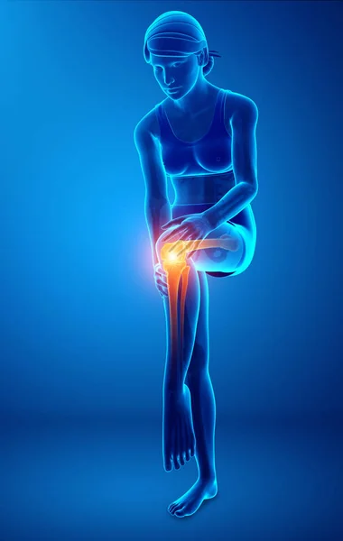Male Knee pain — Stock Photo, Image