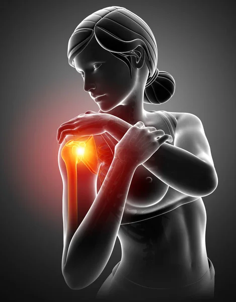 Women Feeling the Shoulder Pain — Stock Photo, Image