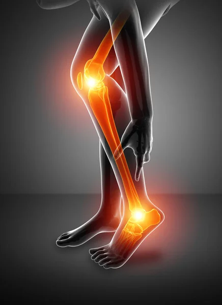 Pain in leg — Stock Photo, Image