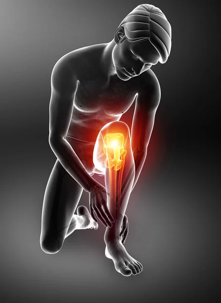 Male Knee pain