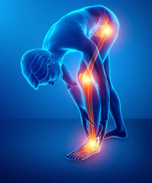 Bacak ağrısı — Stok fotoğraf