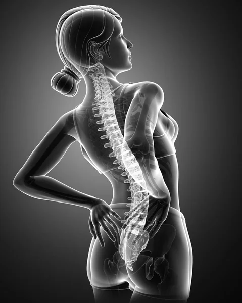 背中の痛みを感じる女性 — ストック写真