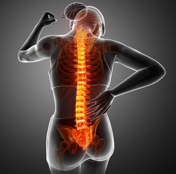 Женщины чувствуют боль в спине
 