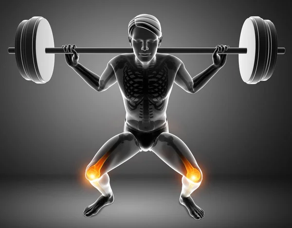 Male Knee pain — Stock Photo, Image