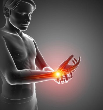 Erkekler bilek ağrı hissi