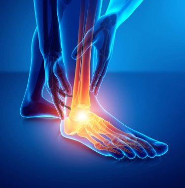 Male foot with ankle pain clipart