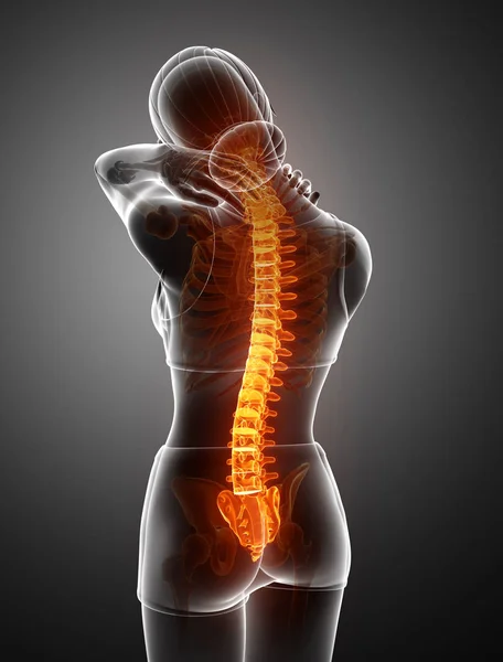 Женщины чувствуют боль в спине — стоковое фото