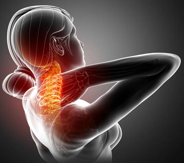 Donne che sentono il dolore al collo — Foto Stock