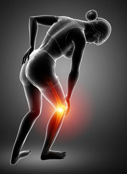 Mujer Knee dolor articular — Foto de Stock