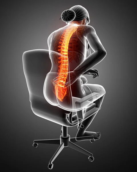 Mujeres sintiendo el dolor de espalda —  Fotos de Stock