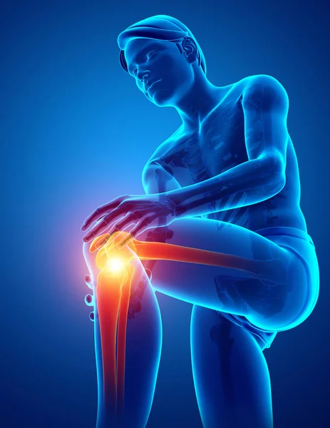 Male Knee pain — Stock Photo, Image