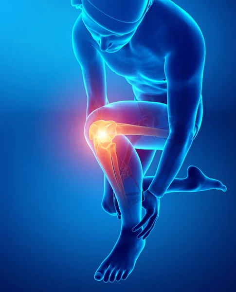 Dolor de rodilla masculino — Foto de Stock